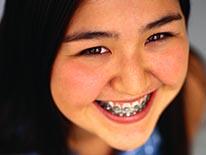 Smiling student Picture of a smiling female student with braises on her teeth