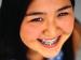 Picture of a smiling female student with braises on her teeth